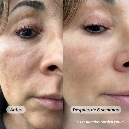 Roll-on Drenaje Facial - Ricino & Incienso